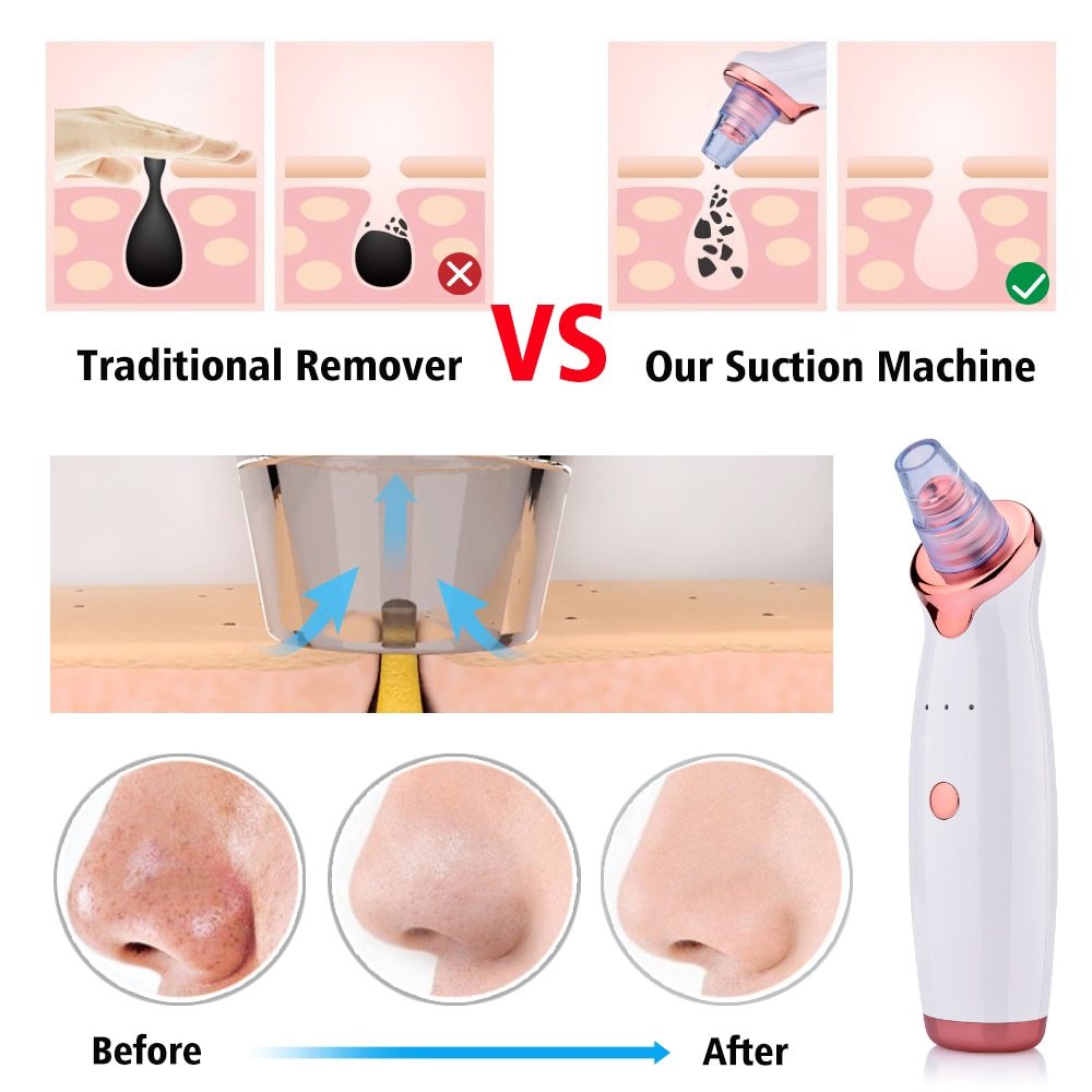 Electric Blackhead Suction Tool