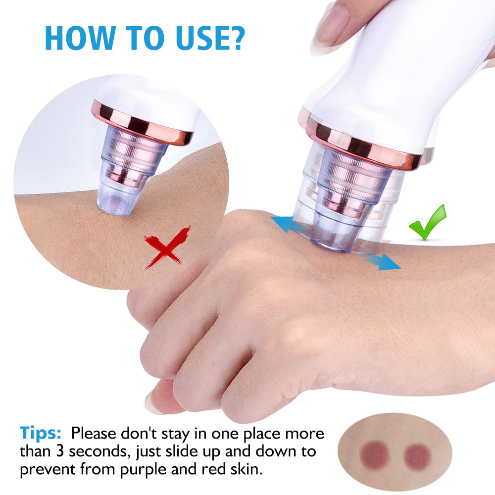 Electric Blackhead Suction Tool